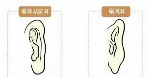 贴脑耳扇风耳